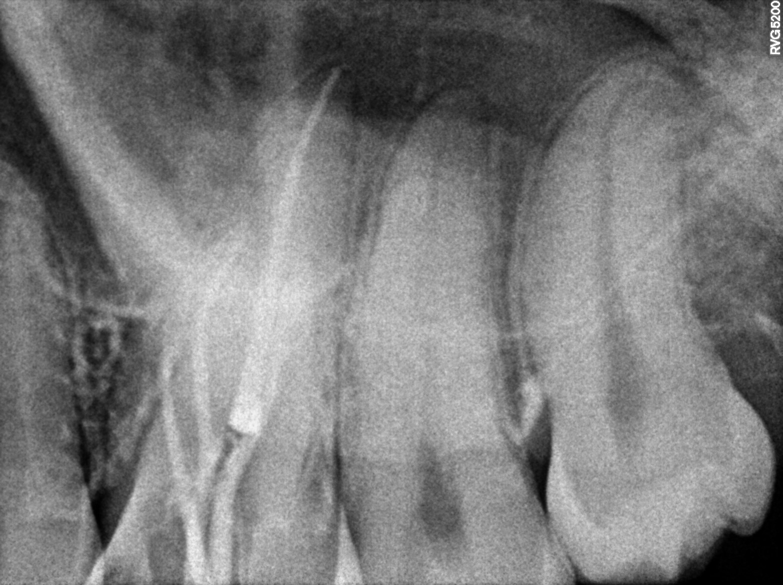 Dental X-ray